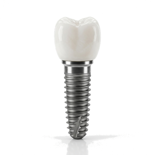 Имплантация зубов